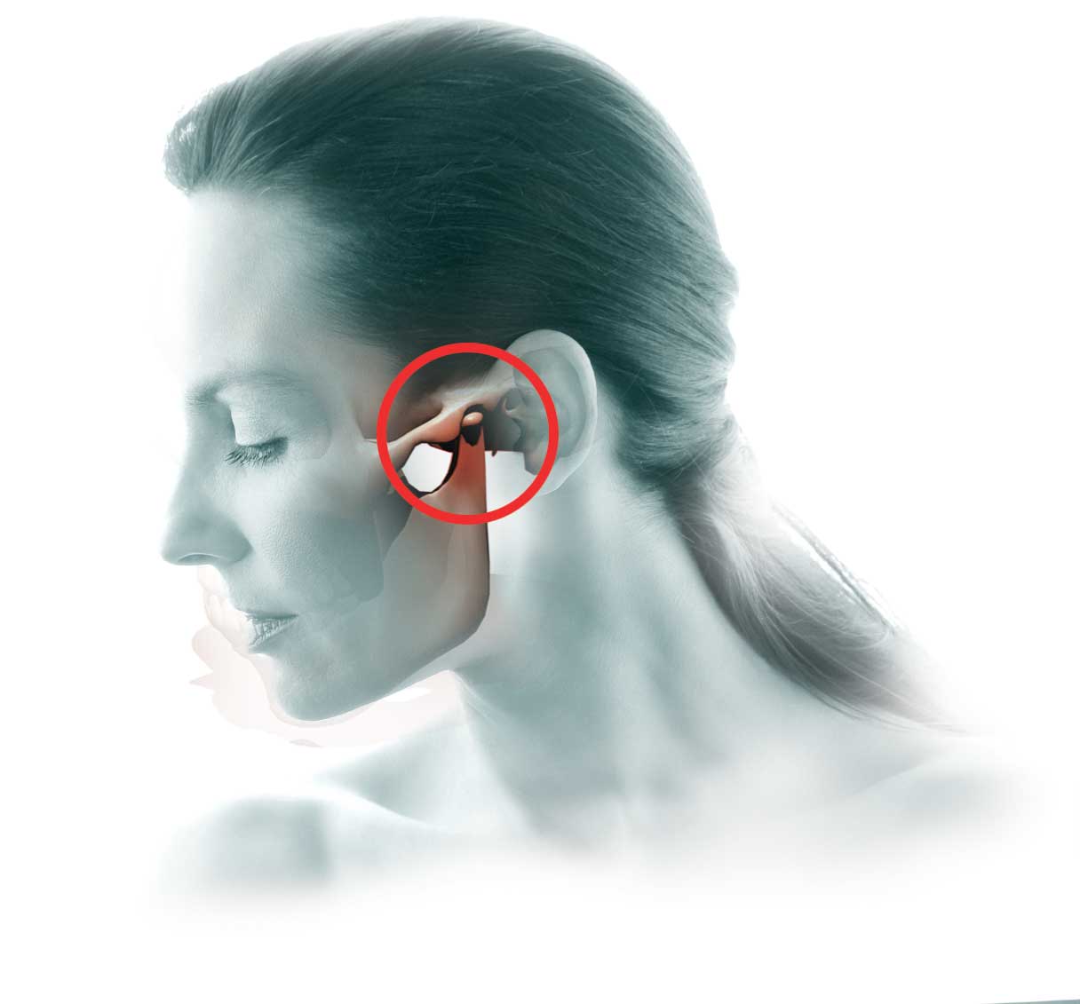 Woman with TMJ